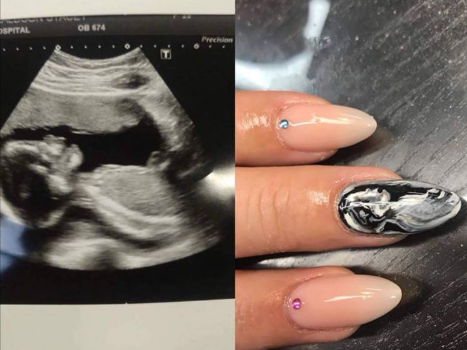 Ora si può avere l'ecografia del feto sulle unghie