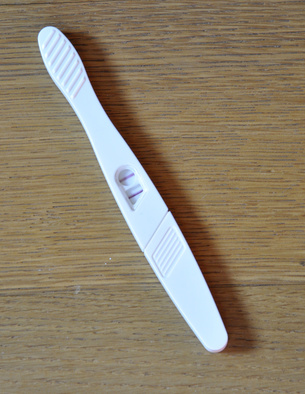 Un esame del sangue per diagnosticare la sindrome di Down in gravidanza