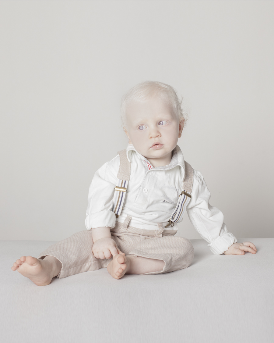 I volti dei bambini albini in un calendario speciale: ecco alcuni degli scatti