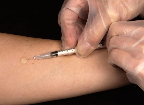 Tre casi di tubercolosi in una scuola di Rimini. L'Ausl: "Nessun allarme"